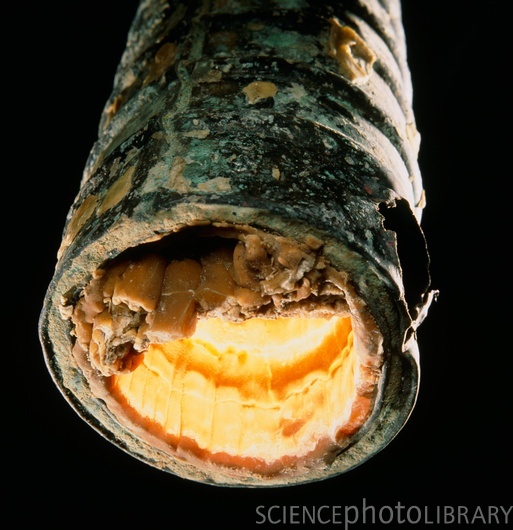 9-Oxidation_and_Reduction_Photos/intro 4 co3 H130212-Limescale_(calcium_deposit)_inside_metal_pipe-SPL.jpg